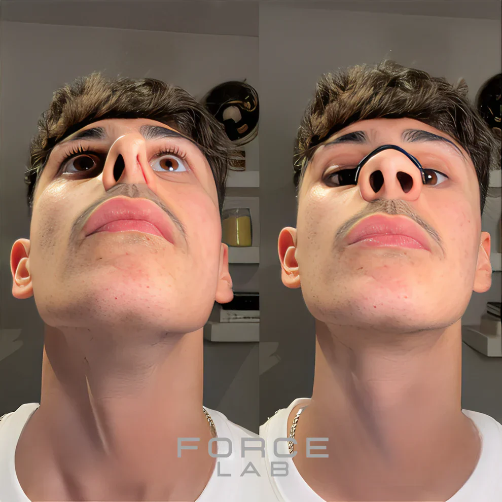 ForceLab™ V2 Tiras nasales magnéticas